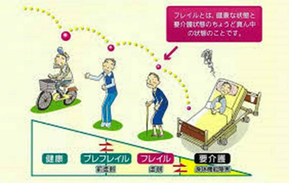 フレイル 健康な状態と要介護の中間 予防のすすめ Npo法人 黄斑変性友の会